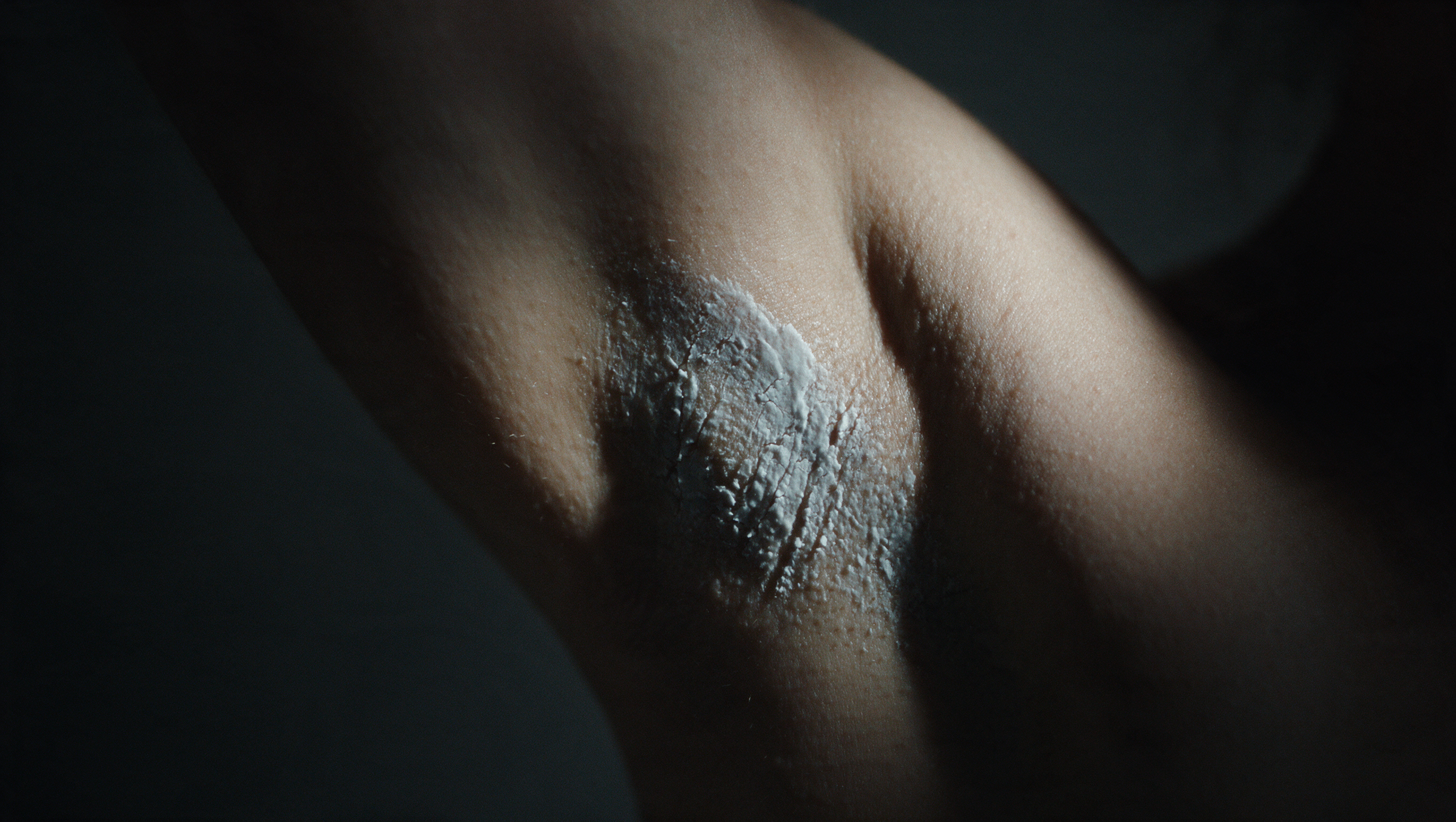 Dried white antiperspirant residue on underarm skin